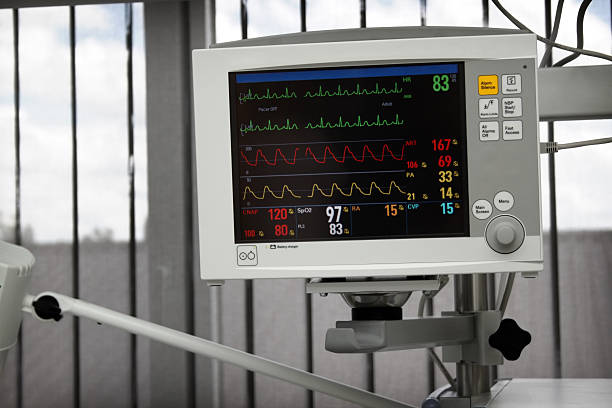 ECG Machine (Electrocardiogram Machine)